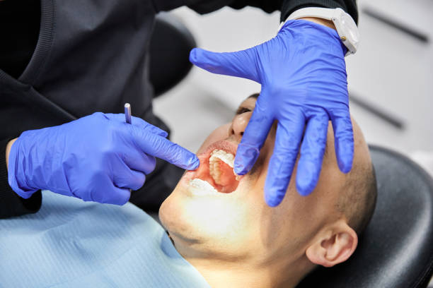 Best Emergency Dentist for Knocked-Out Tooth in Belvedere, SC